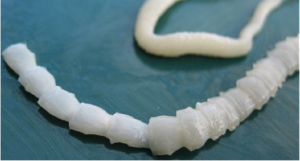 picture of a tapeworm